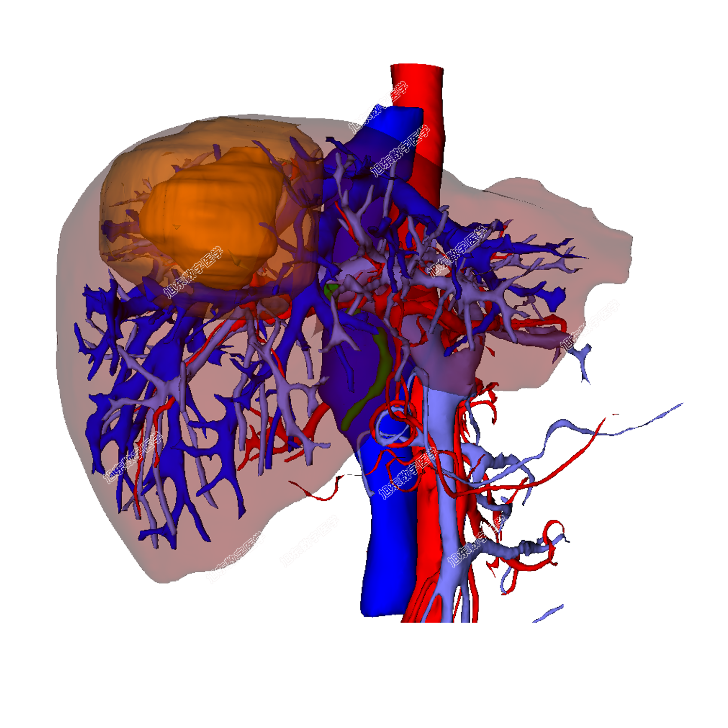 边界扩展确保切缘
